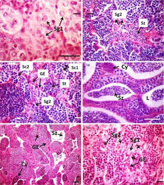 Sardine doree — Araújo FG, Nascimento AA, Gomes ID, Sales A, de Oliveira BAC (2019) Gonadal development and reproductive period of the c / Wikimedia Commons / CC BY 4.0